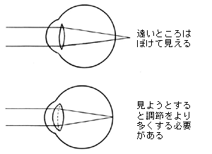 遠視の場合、遠いところがぼけて見えるため、見ようとすると調節をより多くする必要があります。