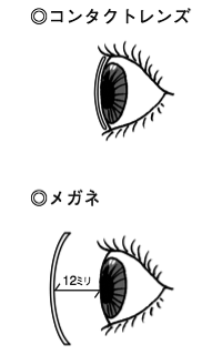 CLは目の上にのせます。メガネのレンズは目から12ミリ程度離れます。