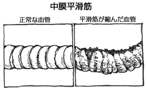 中膜平滑筋は、抵抗血管とも言われる細動脈内部の壁の中にあるコイル状の筋肉層です。