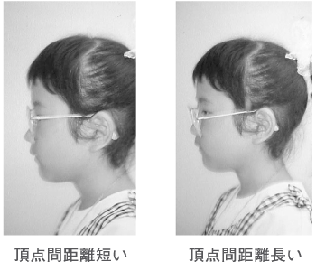 14 メガネを装用する上で調整は必要ですか メガネのかしこい使い方 目についての健康情報 公益社団法人 日本眼科医会