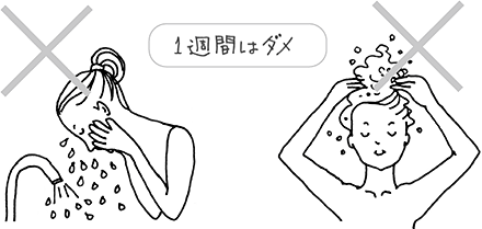 6 日常生活での注意点を教えてください 白内障手術を受ける方へ 知っておきたい白内障術後のケア 目についての健康情報 公益社団法人 日本眼科医会