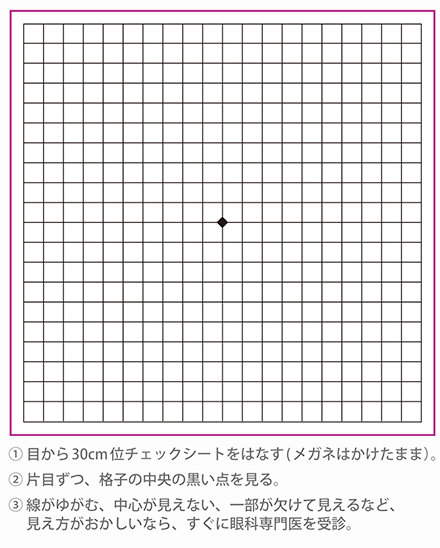 齢 黄斑 変性 加