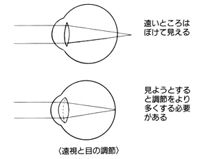 遠視と目の調節について