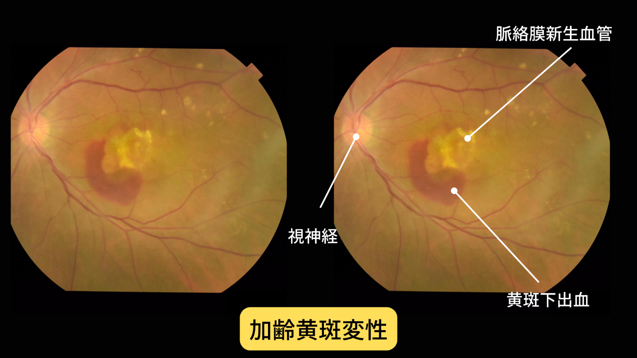 このテストは他の診断ツールとどう違うのですか?